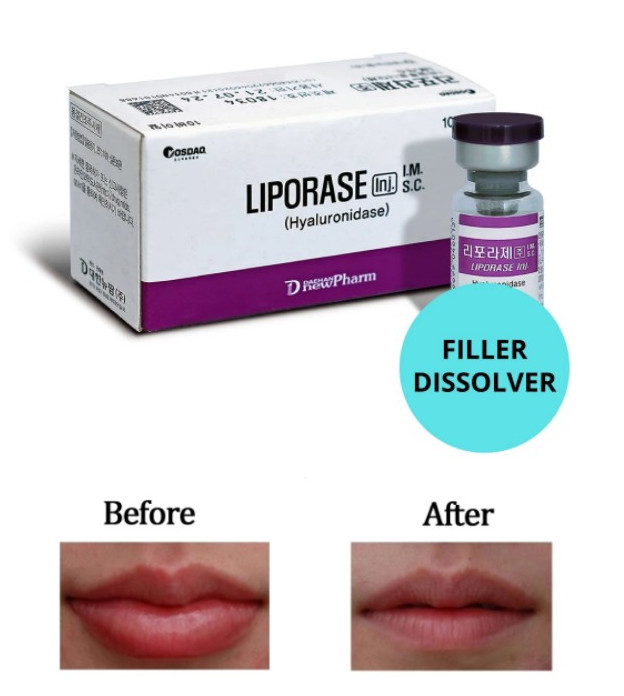 Dissolve Dermal Filler 10 Vials Korean Liporase Hyaluronidase