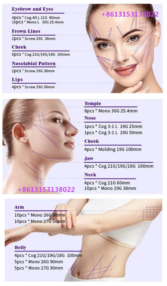 Korea PDO Thread Lift Mono Cog Pdo Face Thread Lift Anti Wrinkles